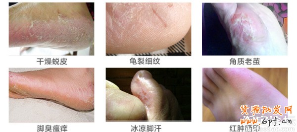 41.【亮鉆計劃】拒絕理由解析——涉及色情丑陋的解決方案